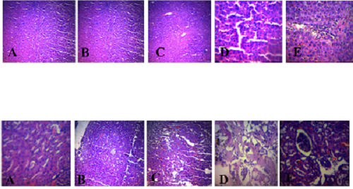 In vitro Antioxidant and Sub-acute toxicity studies of Aqueous extract of White butterfly (Clerodendrum volubile) leaves

