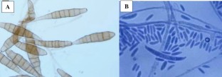 Impact of silicon dioxide nanoparticles on growth, photosynthetic pigments, proline, activities of defense enzymes and some bacterial and fungal pathogens of tomato 