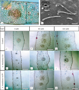 Azospirillum brasilense mitigates anatomical alterations produced by salt stress in jojoba in vitro plants 
