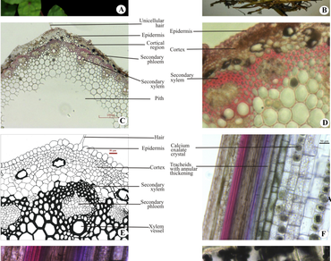 Morphological and anatomical characterization of Fagopyrum esculentum Moench: a highly used medicinal plant in old and new world 