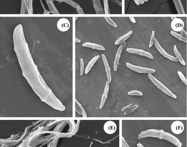 Characterization of pathogens associated with the wilt complex of chickpea in Gujarat, India 