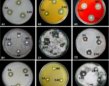 Antimicrobial potential of in vitro and in vivo plant parts of Paeonia emodi Wallich Ex Royle (Himalayan peony) 