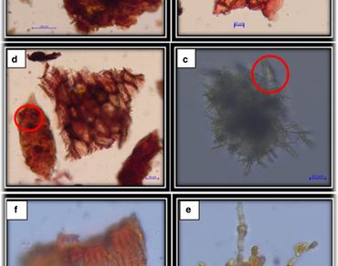 Anatomy, micromorphology, physicochemical analysis, and isolation of fungal endophytes from the leaves of Annona muricata L. (Annonaceae)  