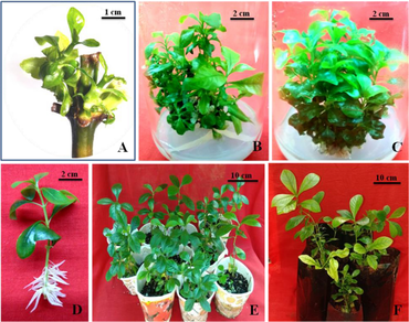 Micro-morpho-anatomical changes in leaf structure of plantlets during in vitro propagation (micropropagation) of Gardenia jasminoides J. Ellis