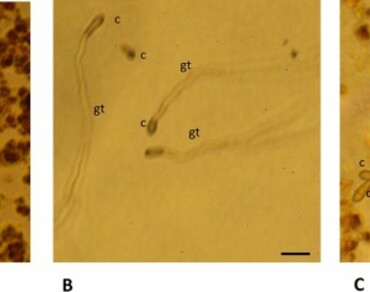 Optimization of the process for obtaining Morinda royoc crude extract bioactive against phythopathogens