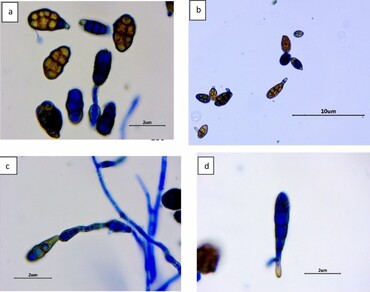 First report of Alternaria aungustiovoidea mediated leaf anomalies in Abelmoschus esculentus in Greater Kolkata, India