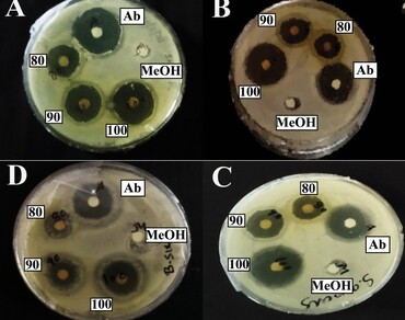 Antibacterial activity and GC–MS profiling of Stephania glandulifera Miers root extract