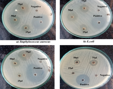 The activities of the methanolic extract of Eranthemum roseum on biological functions: antioxidants, anti-proliferative, anti-inflammatory, anti-diabetic, ADMET and in silico studies