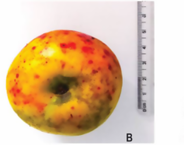 Comparative biochemical evaluation of the proximate content, antioxidant properties, and phytochemical constituents of ethnomedicinally important Docynia indica from Northeast India