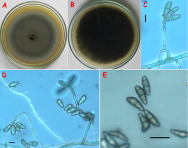 Deciphering the new pinpoint leaf disease in India caused by Curvularia dactyloctenicola on Costus speciousus
