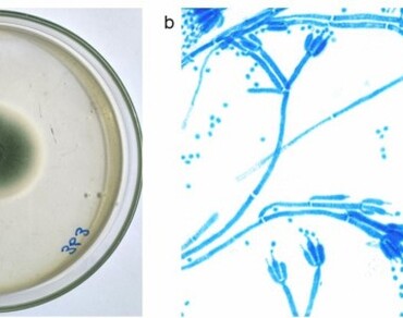 Citrinin (CIT), a polyketide mycotoxin from a mangrove endophytic fungus Penicillium rubens EF 363 and its bioactive potential