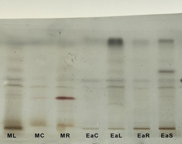 Antimicrobial activity and qualitative assessment of β-Sitosterol, lupeol, and quercetin from extracts of Leptadenia reticulata