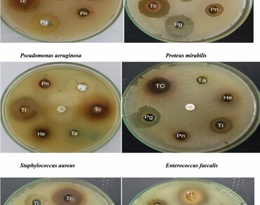 Phytochemical analysis of six medicinal plants through gas chromatography–mass spectrometry (GC–MS) and evaluation of their antibacterial activity against clinically isolated MDR uropathogens