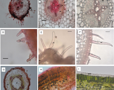 Comparative anatomy of five species of Senna Mill. (Leguminosae) from Bangladesh