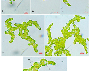 Interfilum shuklaii (Klebsormidiaceae): a morphologically distinct new edaphic alga from the Western Ghats, India