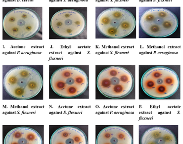 Phytochemical analysis and evaluation of antibacterial activity of some important medicinal plants against pathogenic bacteria